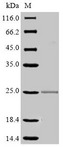 FCGR3 Protein - (Tris-Glycine gel) Discontinuous SDS-PAGE (reduced) with 5% enrichment gel and 15% separation gel.