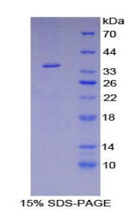 FCN1 / Ficolin-1 Protein - Recombinant Ficolin 1 By SDS-PAGE