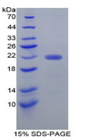 FCN2 / Ficolin-2 Protein - Recombinant Ficolin 2 By SDS-PAGE