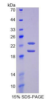 FGF2 / Basic FGF Protein - Recombinant Fibroblast Growth Factor 2, Basic By SDS-PAGE