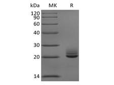 FGF21 Protein - Recombinant Mouse Fibroblast Growth Factor 21/FGF-21 (C-6His)