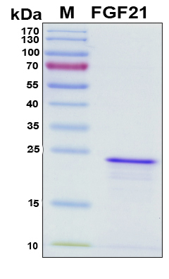 FGF21 Protein - SDS-PAGE under reducing conditions and visualized by Coomassie blue staining