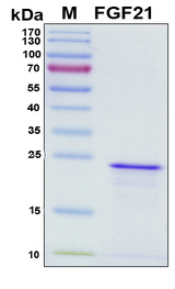 FGF21 Protein - SDS-PAGE under reducing conditions and visualized by Coomassie blue staining