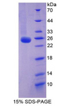FGF21 Protein