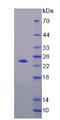 FGF21 Protein - Recombinant  Fibroblast Growth Factor 21 By SDS-PAGE