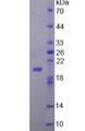 FGF22 Protein - Active Fibroblast Growth Factor 22 (FGF22) by SDS-PAGE