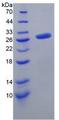 FGF23 Protein - Active Fibroblast Growth Factor 23 (FGF23) by SDS-PAGE