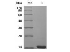 FGF4 Protein - Recombinant Mouse Fibroblast Growth Factor 4/FGF-4