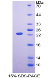 FGF6 Protein - Recombinant Fibroblast Growth Factor 6 By SDS-PAGE