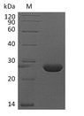 FGF9 Protein - (Tris-Glycine gel) Discontinuous SDS-PAGE (reduced) with 5% enrichment gel and 15% separation gel.
