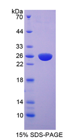 FGFR4 Protein - Recombinant  Fibroblast Growth Factor Receptor 4 By SDS-PAGE