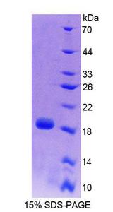FH / Fumarase / MCL Protein - Recombinant Fumarase By SDS-PAGE