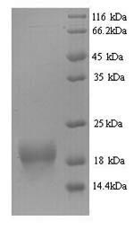 FHIT Protein - (Tris-Glycine gel) Discontinuous SDS-PAGE (reduced) with 5% enrichment gel and 15% separation gel.