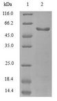 Fibulin-3 / EFEMP1 Protein - (Tris-Glycine gel) Discontinuous SDS-PAGE (reduced) with 5% enrichment gel and 15% separation gel.