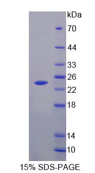 FLRT1 Protein - Recombinant Fibronectin Leucine Rich Transmembrane Protein 1 (FLRT1) by SDS-PAGE