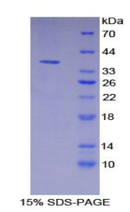 FLT4 / VEGFR3 Protein - Recombinant Vascular Endothelial Growth Factor Receptor 3 By SDS-PAGE