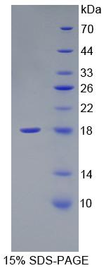 FN1 / Fibronectin Protein - Recombinant Fibronectin By SDS-PAGE