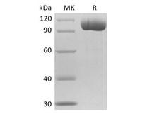 FOLH1 / PSMA Protein - Recombinant Mouse FGCP/GCPII/mGCP/NAALADase I/PSMA(N-6His)