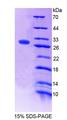 FPGS Protein - Recombinant Folylpolyglutamate Synthase, Mitochondrial By SDS-PAGE