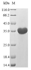 FPR2 / FPRL1 Protein - (Tris-Glycine gel) Discontinuous SDS-PAGE (reduced) with 5% enrichment gel and 15% separation gel.