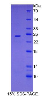 FR4 / Folate Receptor 4 Protein - Recombinant Folate Receptor 4 Delta By SDS-PAGE