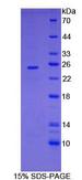FR4 / Folate Receptor 4 Protein - Recombinant Folate Receptor 4 Delta By SDS-PAGE