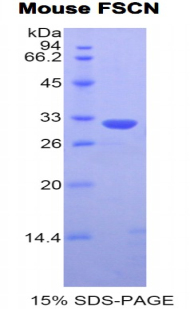 FSCN1 / Fascin Protein - Recombinant Fascin By SDS-PAGE