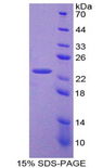 FXN / Frataxin Protein - Recombinant Frataxin By SDS-PAGE