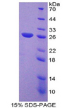 FZD1 / Frizzled 1 Protein - Recombinant Frizzled Homolog 1 By SDS-PAGE
