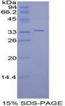 FZD10 / Frizzled 10 Protein - Recombinant Frizzled Homolog 10 (FZD10) by SDS-PAGE