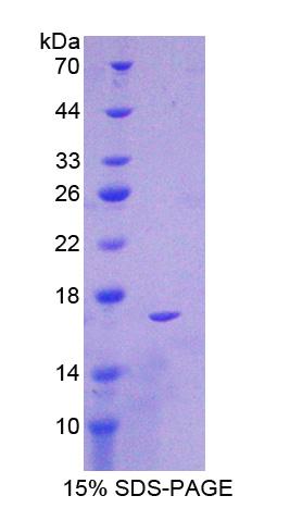 G6PD Protein - Recombinant  Glucose 6 Phosphate Dehydrogenase By SDS-PAGE