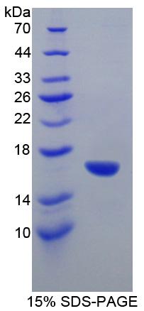 GAD1 / GAD67 Protein - Recombinant Glutamate Decarboxylase 1, Brain By SDS-PAGE