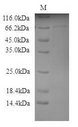 GALC / Galactocerebrosidase Protein - (Tris-Glycine gel) Discontinuous SDS-PAGE (reduced) with 5% enrichment gel and 15% separation gel.