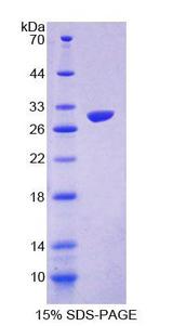 GAMT Protein - Recombinant  Guanidinoacetate-N-Methyltransferase By SDS-PAGE