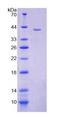 GANAB / Alpha Glucosidase II Protein - Recombinant Glucosidase Alpha, Neutral AB (GaNAB) by SDS-PAGE