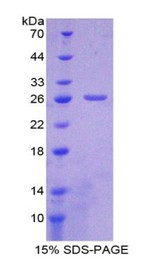 GAP43 Protein - Recombinant Growth Associated Protein 43 By SDS-PAGE