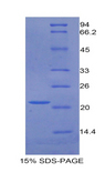 GAS6 Protein - Recombinant Growth Arrest Specific Protein 6 By SDS-PAGE