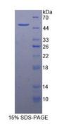 GAS6 Protein - Recombinant Growth Arrest Specific Protein 6 By SDS-PAGE