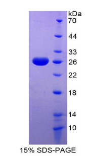 GATA2 Protein - Recombinant GATA Binding Protein 2 By SDS-PAGE
