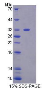 GBP2 Protein - Recombinant Guanylate Binding Protein 2, Interferon Inducible (GBP2) by SDS-PAGE