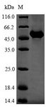 GC / Vitamin D-Binding Protein Protein - (Tris-Glycine gel) Discontinuous SDS-PAGE (reduced) with 5% enrichment gel and 15% separation gel.