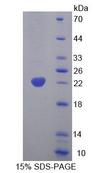 GCD / GCDH Protein - Recombinant Glutaryl Coenzyme A Dehydrogenase (GCDH) by SDS-PAGE