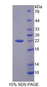 GCG / Glucagon Protein - Recombinant Glucagon By SDS-PAGE