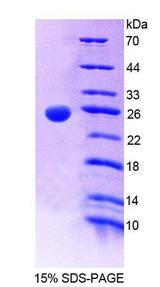 GCL / Grancalcin Protein - Recombinant  Grancalcin By SDS-PAGE