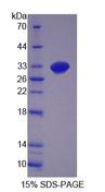 GDF11 / GDF-11 Protein - Recombinant Growth Differentiation Factor 11 (GDF11) by SDS-PAGE