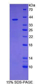 GFAP Protein - Recombinant Glial Fibrillary Acidic Protein By SDS-PAGE