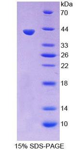 GFRA1 / GFR Alpha Protein - Recombinant  Glial Cell Line Derived Neurotrophic Factor Receptor Alpha 1 By SDS-PAGE