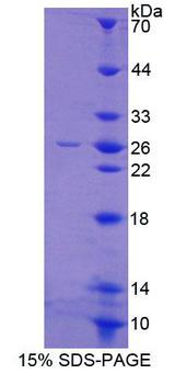 GFRA2 Protein - Recombinant Glial Cell Line Derived Neurotrophic Factor Receptor Alpha 2 By SDS-PAGE
