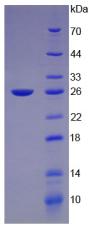 GH / Growth Hormone Protein - Recombinant Growth Hormone By SDS-PAGE