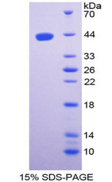 Ghrelin Protein - Recombinant  Ghrelin By SDS-PAGE